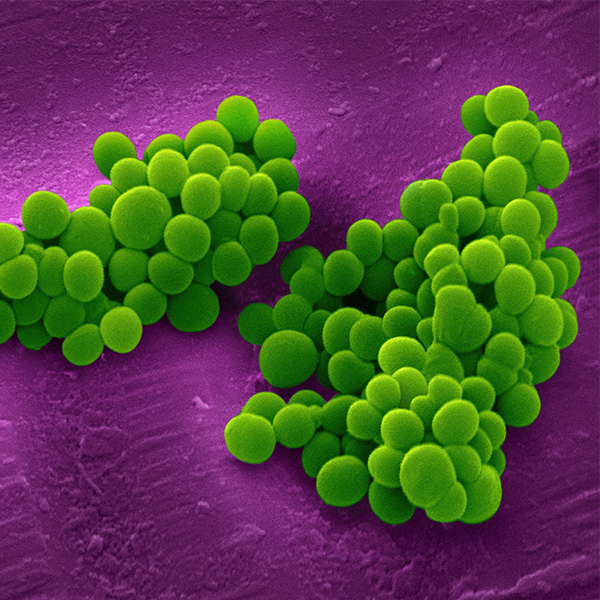amr-in-bacterial-pathogens